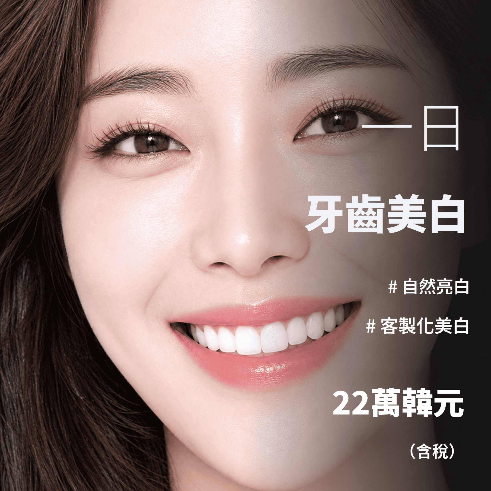 單日客製牙齒美白 2次