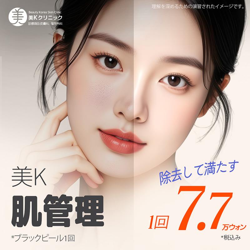 美K 老廃物の掃除  ブラックピール 1回