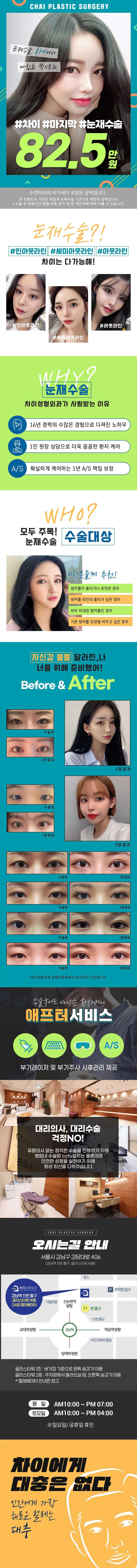 강남역 차이성형외과의원의 맞춤형 눈 재수술 홍보 이미지로, 82.5만원의 합리적 가격과 자연스러운 눈매 교정을 강조