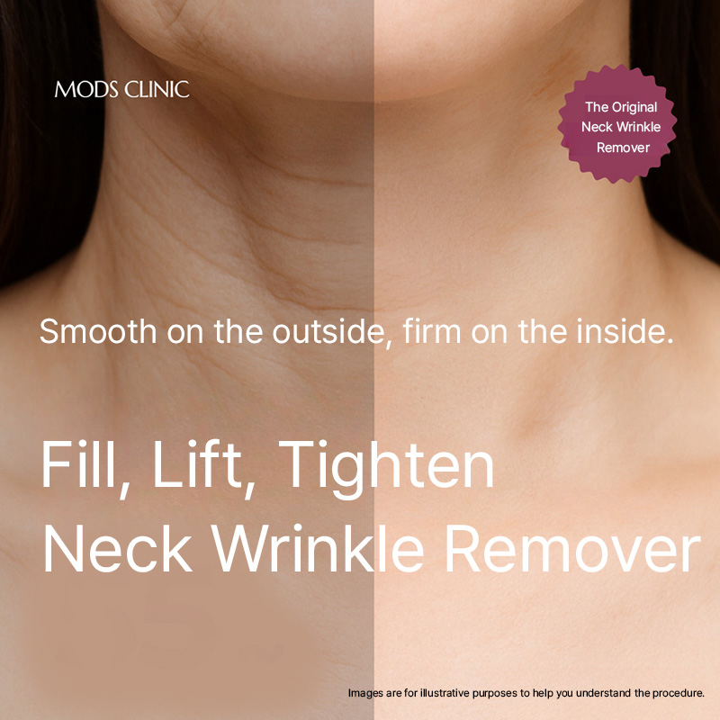 Cheongdam Neck Wrinkle Remover