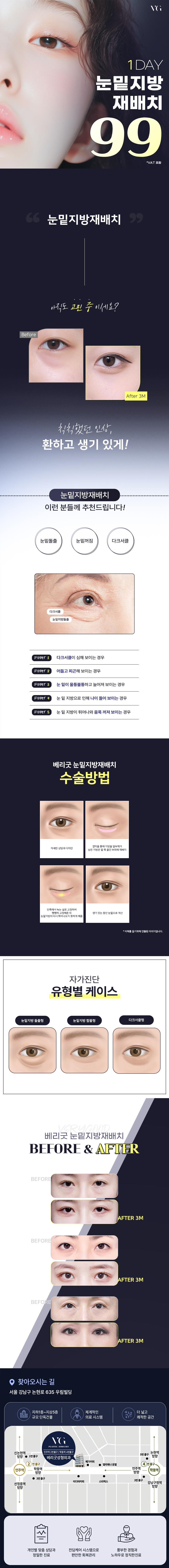 서울 신논현에 위치한 베리굿성형외과의원에서 제공하는 눈밑지방재배치 시술은 눈밑 지방 제거, 다크서클 개선, 눈밑 지방 이식을 통해 눈밑의 굴곡을 개선하는 종합적인 시술입니다.