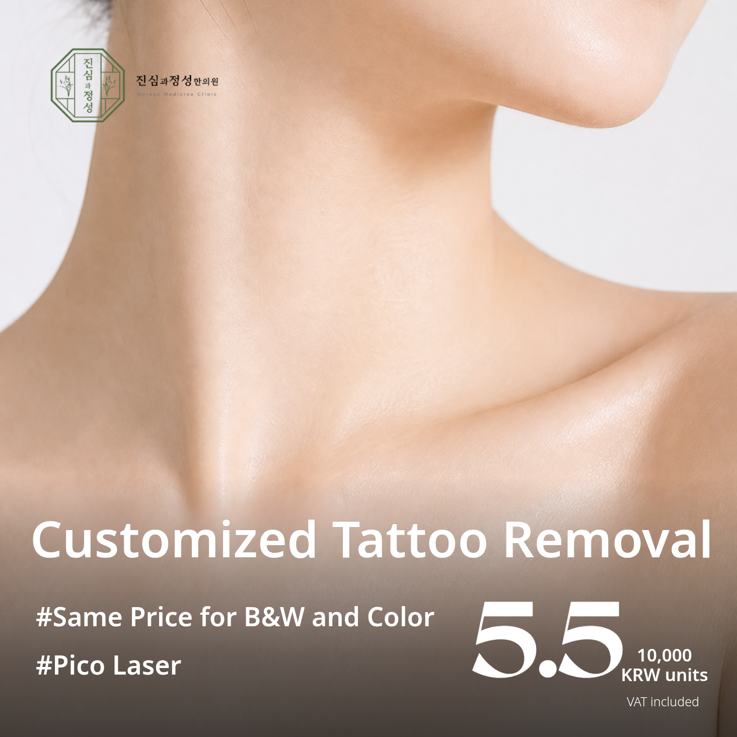 Custom Laser Tattoo Removal