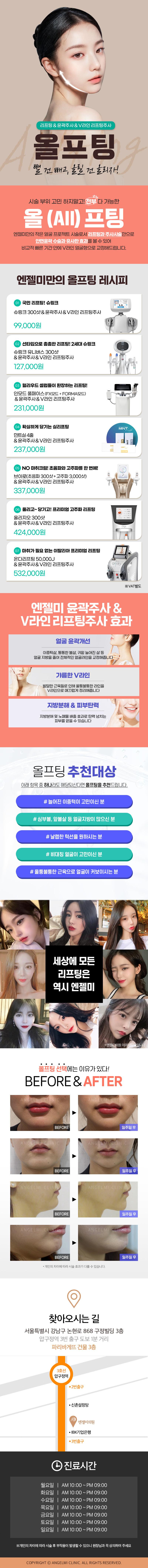 압구정 엔젤미의원의 올프팅 패키지: 슈링크300샷, 윤곽주사, V라인리프팅 주사를 9.9만원에 통합 제공하는 특가 프로모션