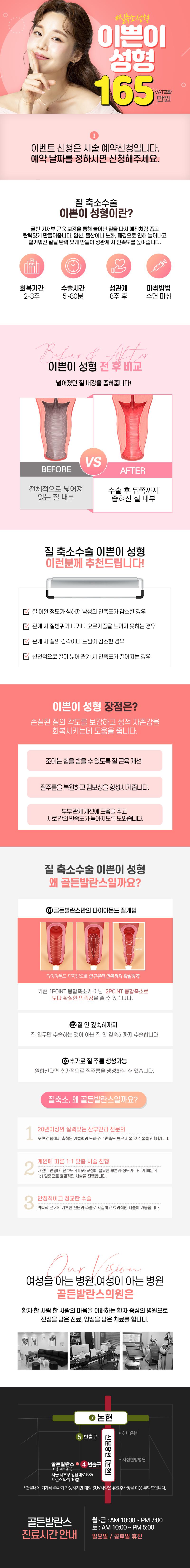 골든발란스의원의 황금비율 이쁜이 성형 - 소음순/질필러/질축소 등 여성 성형 복합 시술 165만원