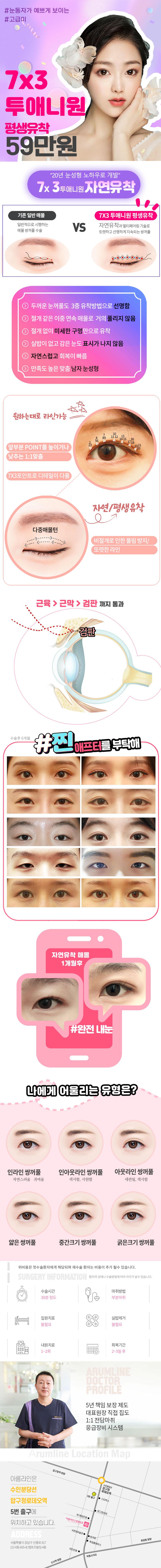 서울 압구정 아름라인의원의 7x3 투애니원 평생유착 쌍꺼풀 수술, 21홀 자연스러운 라인으로 59만원