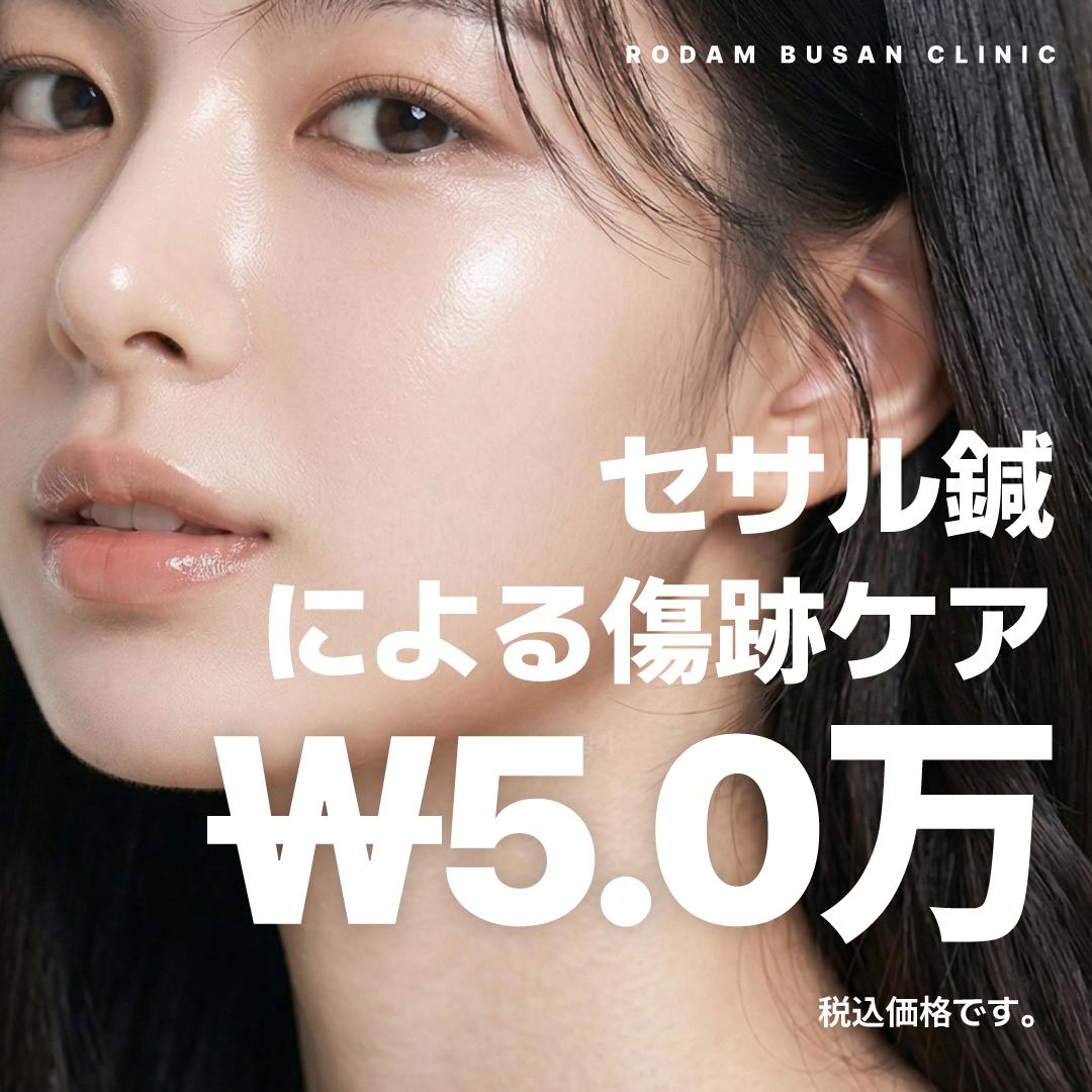 ニキビ跡(クレーター)には [コラセラピー]