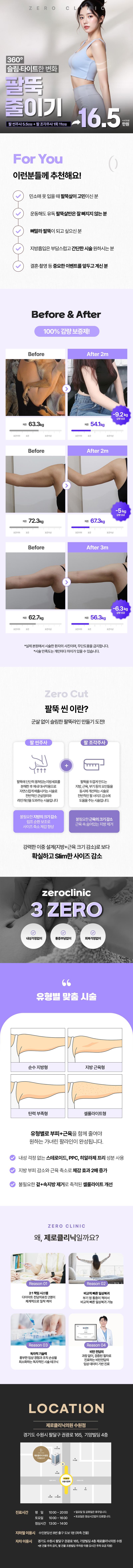 제로의원(수원점)에서 제공하는 팔뚝 윤곽주사 조각주사는 16.5만원에 팔뚝 부위의 지방을 흡입 및 분해하여 확실한 팔뚝 라인을 만들어 줍니다.