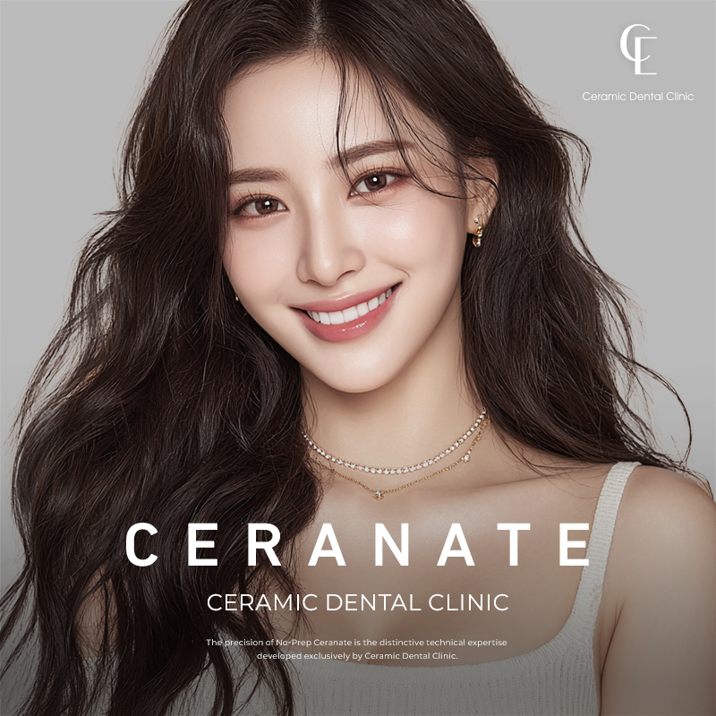 Customizing Full Ceraminate