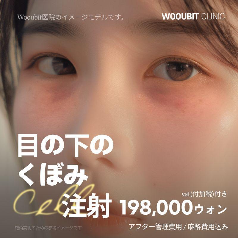 目の下のくぼみCell注射