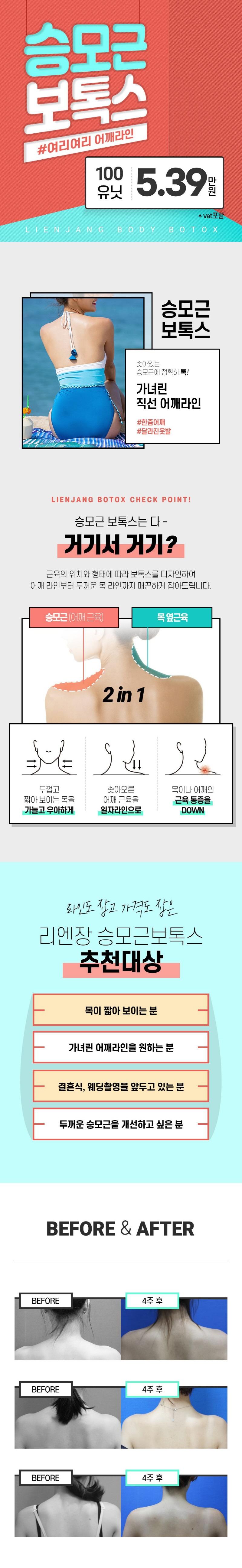 인천 구월동 리엔장의원의 승모근보톡스 시술로 울퉁불퉁한 알통 없애고 여리여리한 바디라인 만들기