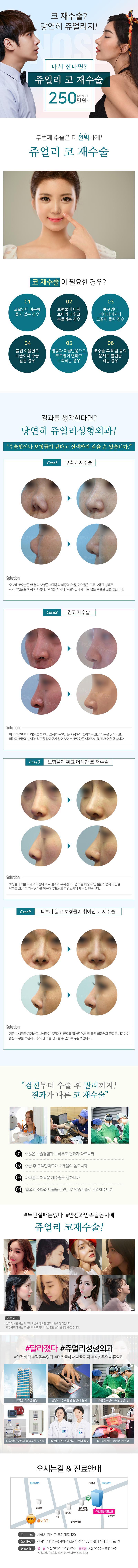 경기 고양시 소재 영선TEST_SPRINT 병원의 코성형 시술 이벤트로, 4.5만원의 가격으로 제공되는 코 교정 수술 프로모션