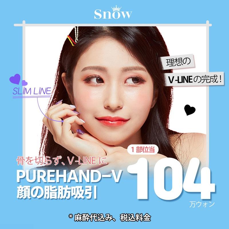 スノウ顔の脂肪吸引