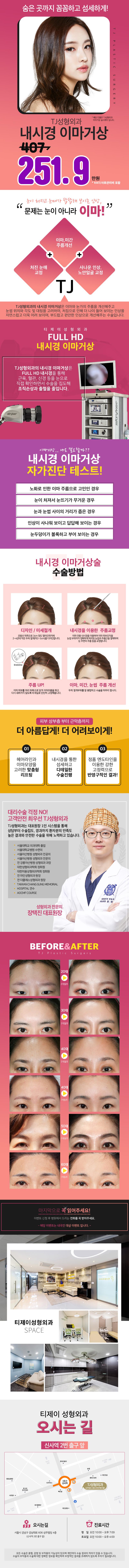 서울 신사 티제이성형외과의원의 TJ 내시경 이마거상술: 이마주름교정 & 눈썹교정 & 예뻐지는 이마라인