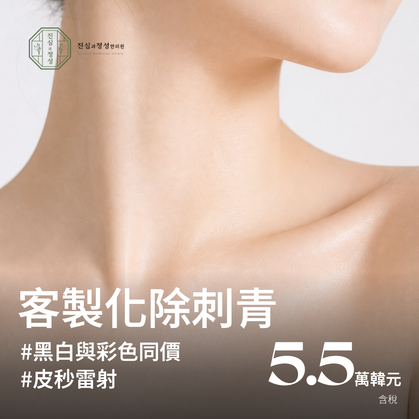激光定制纹身去除