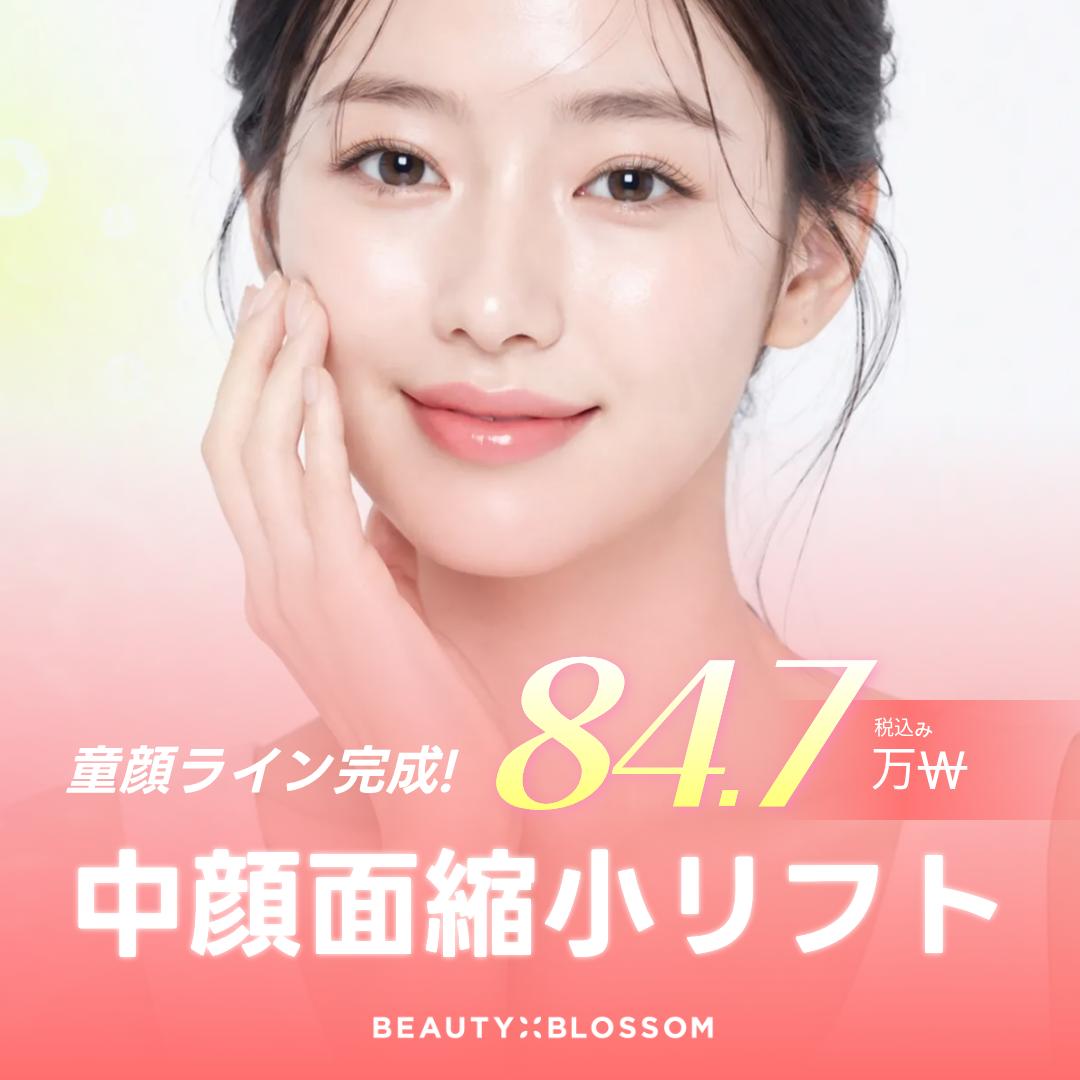 中顔面縮小リフト