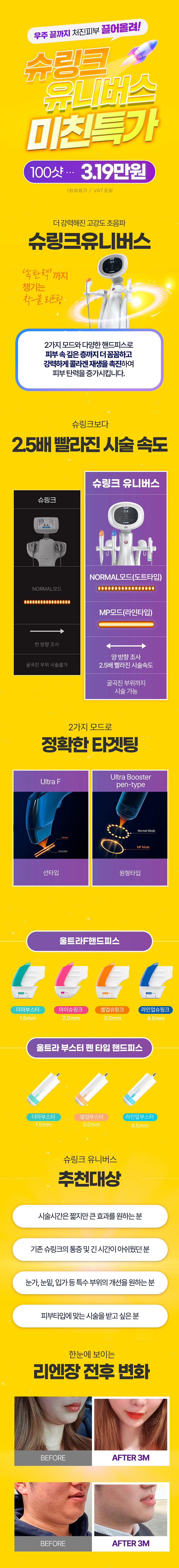 하남 리엔장의원의 슈링크유니버스 시술은 2가지 모드의 강력한 초음파로 탄력저하 및 페이스라인 개선을 제공하는 3.19만원의 특화 프로그램