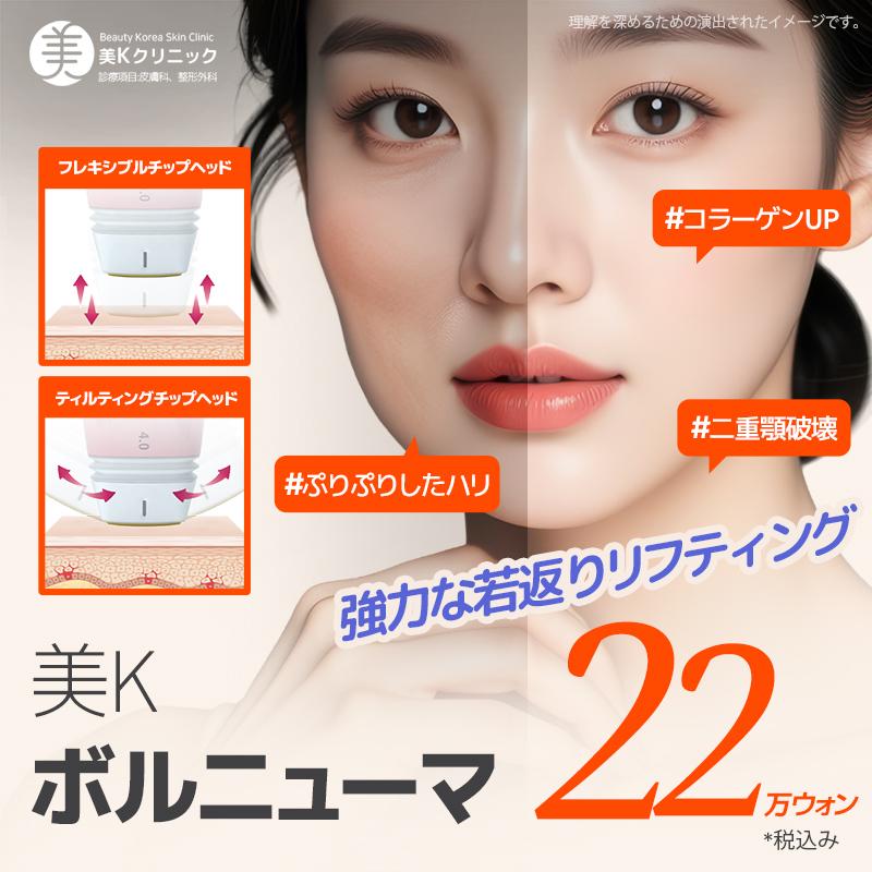 美K ボルニューマ