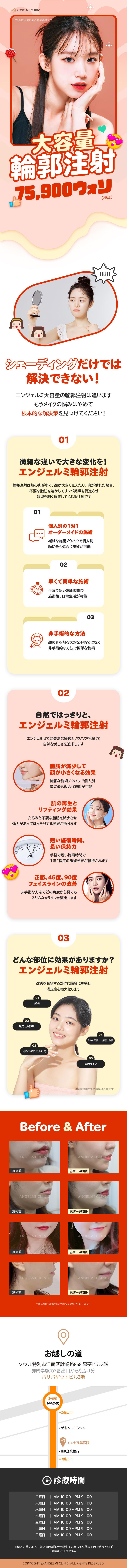 大容量輪郭注射 Vライン、二重あご、無顎、脂肪分解、顔のライン