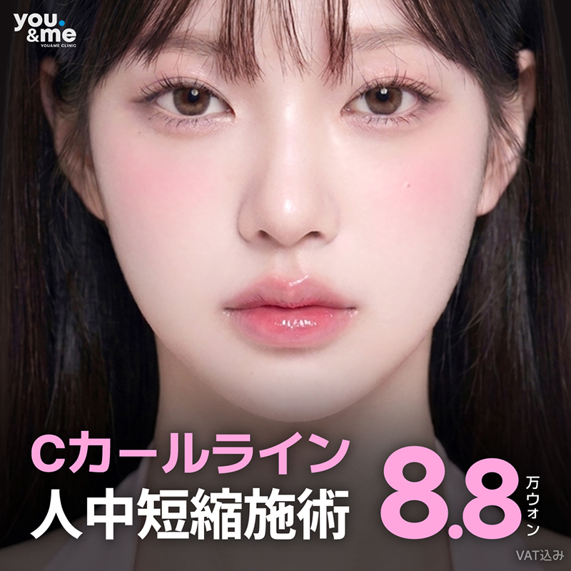 人中短縮施術、人中の長さの短縮&唇のボリューム&口角の矯正