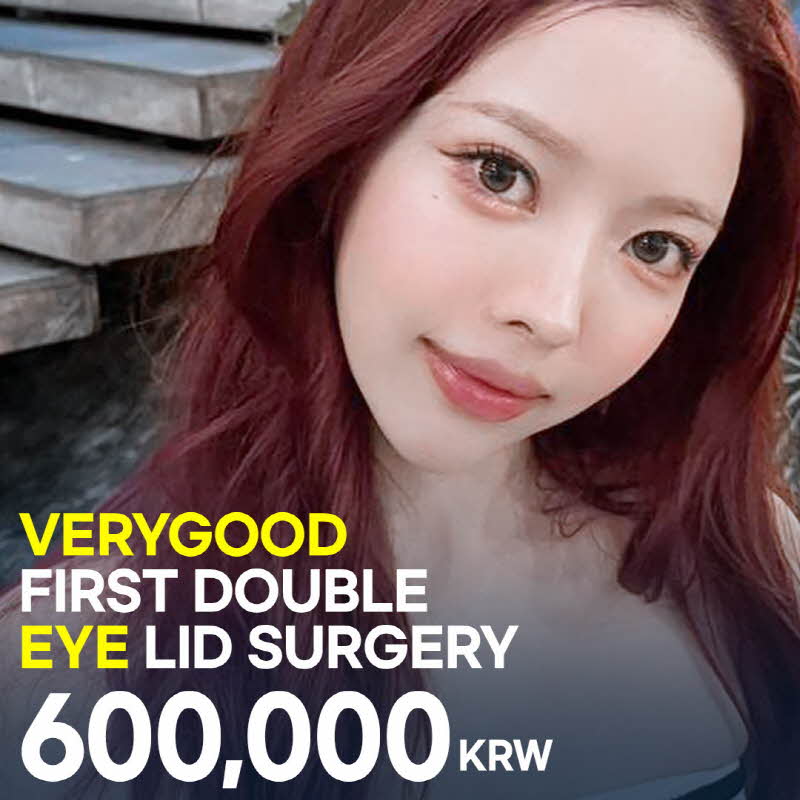 Natural adhesion double eyelid surgery