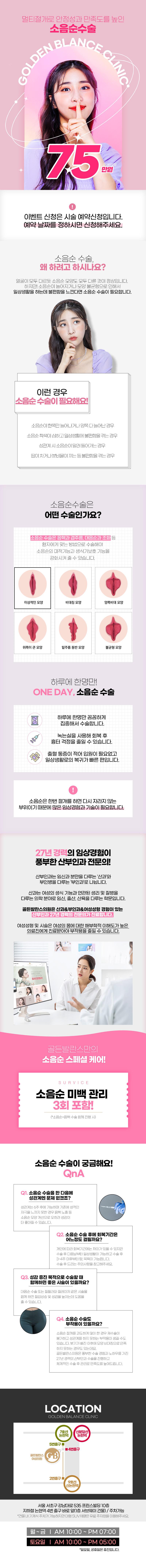 서울 역삼 골든발란스의원의 75만원 소음순 성형 이벤트 프로모션 안내