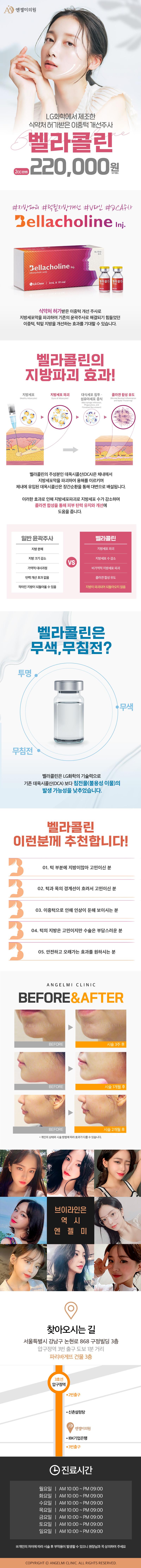 압구정 엔젤미의원의 V라인/이중턱 개선을 위한 벨라콜린 지방분해 주사 시술 (22만원)