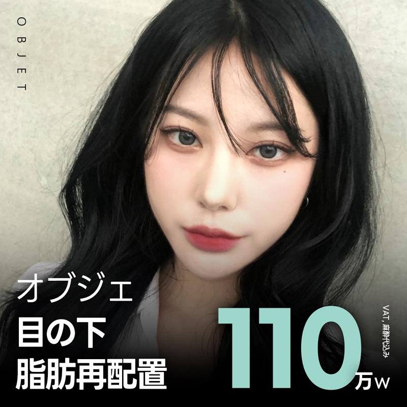 オブジェ目の下脂肪再配置