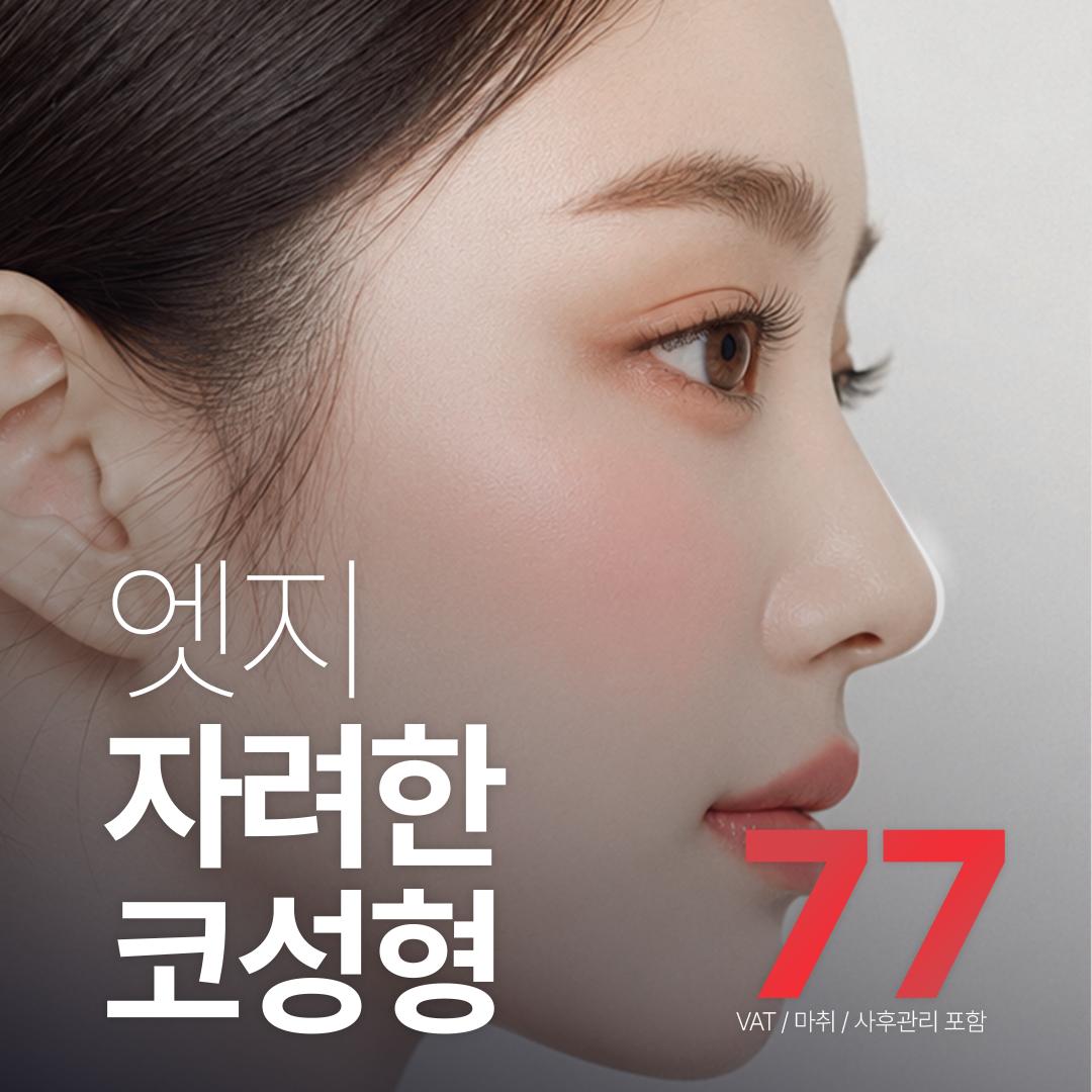 엣지성형외과의원 대구 엣지 자려한 코성형_복코, 코끝 이벤트 이미지