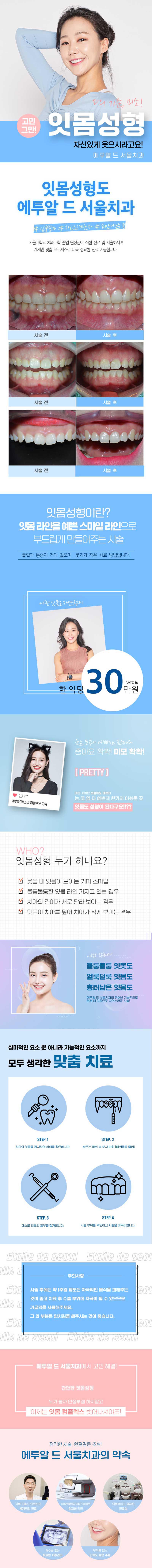 청담 에투알드서울치과의원의 거미스마일 교정 시술로 웃을 때 보이는 과도한 잇몸을 개선하는 30만원대 잇몸성형 프로그램