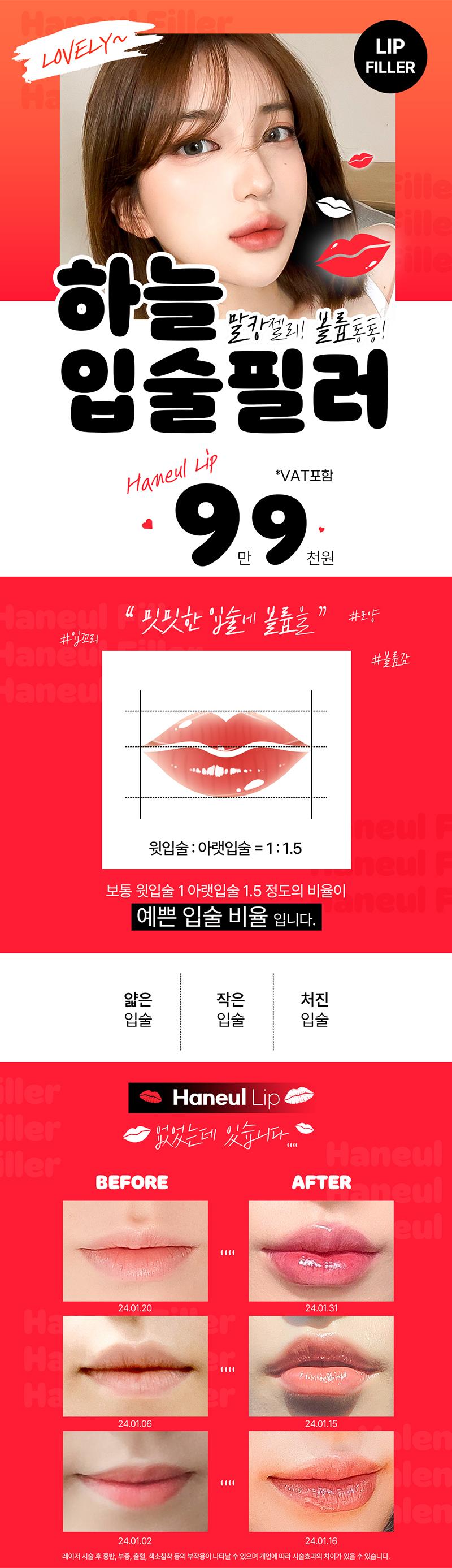 부산 서면에 위치한 하늘성형외과의원에서 도톰하고 매력적인 입술을 만들어주는 하늘 입술필러를 9.9만원에 제공합니다.