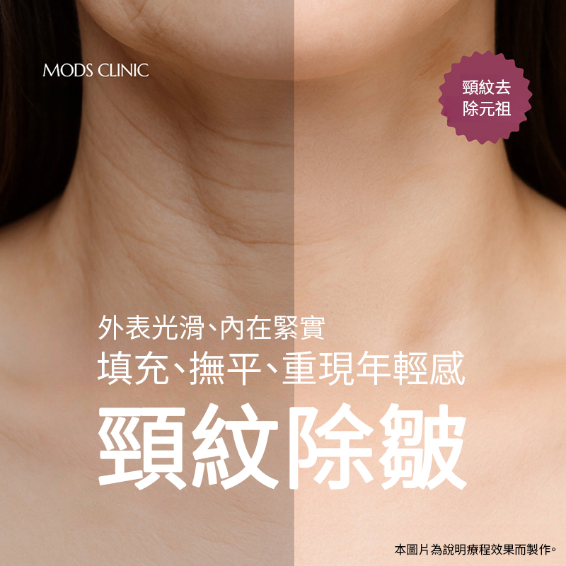 清潭頸紋去除療程