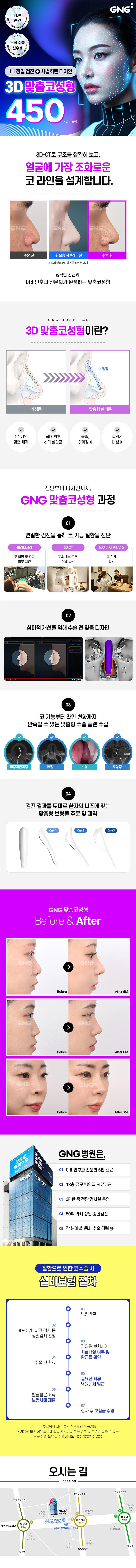 지앤지병원의 GNG 3D 맞춤 코성형은 3D-CT 촬영과 정밀 검진을 통해 개인에게 맞춤형 디자인으로 제공되는 코성형 서비스입니다.
