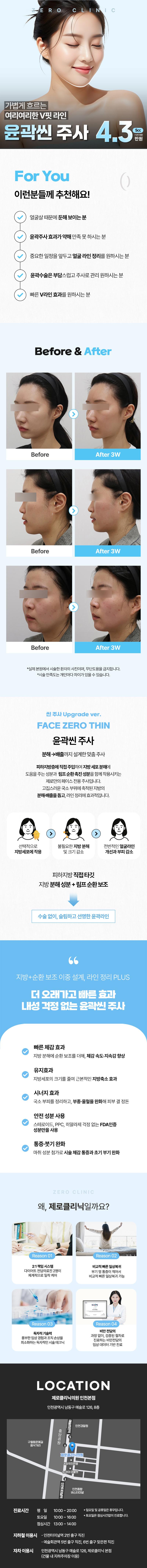 제로의원 인천점에서 제공하는 제로 윤곽 지방분해주사는 둔한 얼굴라인을 개선하고 브이라인 얼굴을 만들고 싶지만 수술은 무서운 분들을 위한 시술입니다.