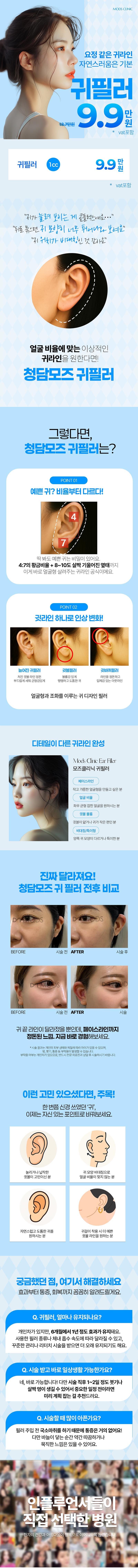 청담모즈의원의 엘프귀필러 시술로 개인맞춤 귀라인 디자인과 중안면부 보완 효과를 제공하는 프리미엄 귀성형 시술