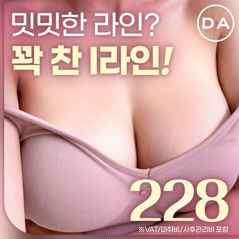 디에이 I라인가슴성형