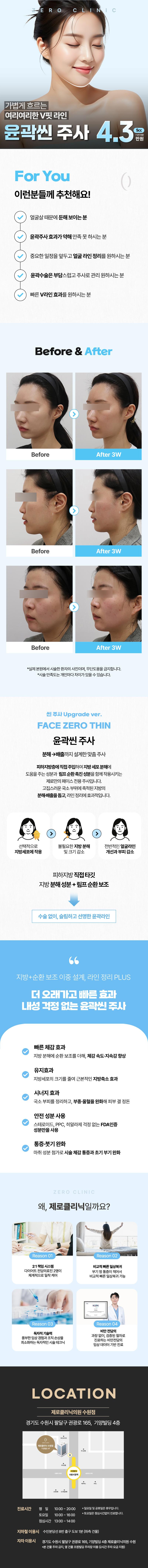 제로의원(수원점)의 제로 윤곽 지방분해주사는 둔한 얼굴라인을 개선하고 브이라인 얼굴을 만들고 싶지만 수술은 무서운 분들을 위한 비수술 방법으로 4.3만원에 제공됩니다.