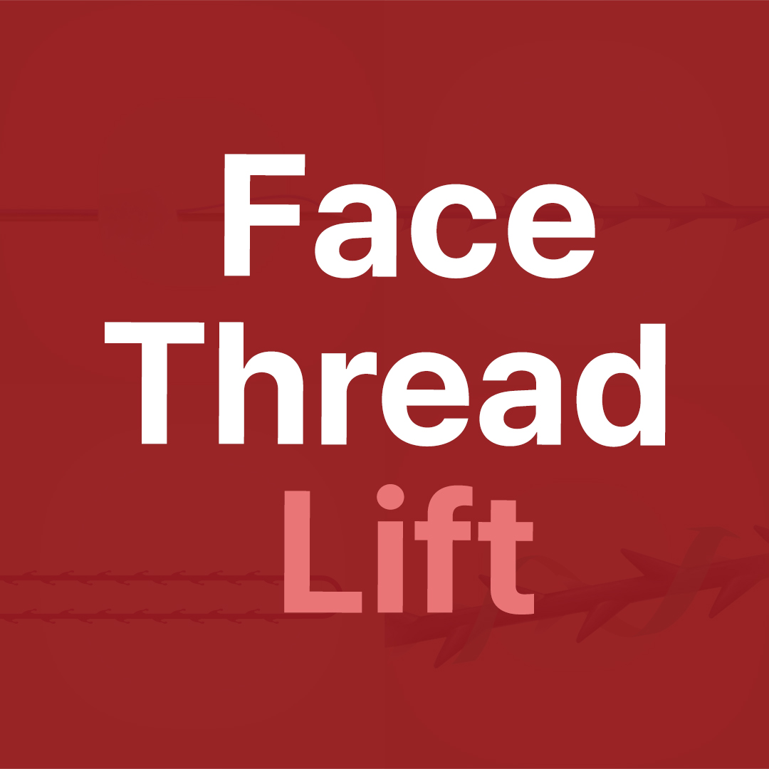 FDA-Approved Thread Lift
