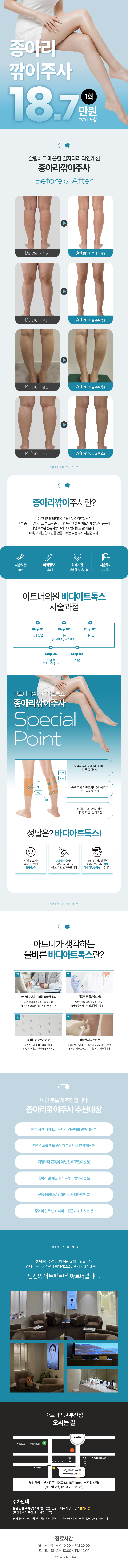 아트너의원(부산점)에서 제공하는 종아리깎이주사 지방분해 서비스, 18.7만원