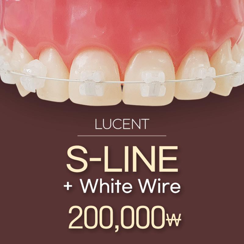 自然で目立たない、S-LINE 歯列矯正