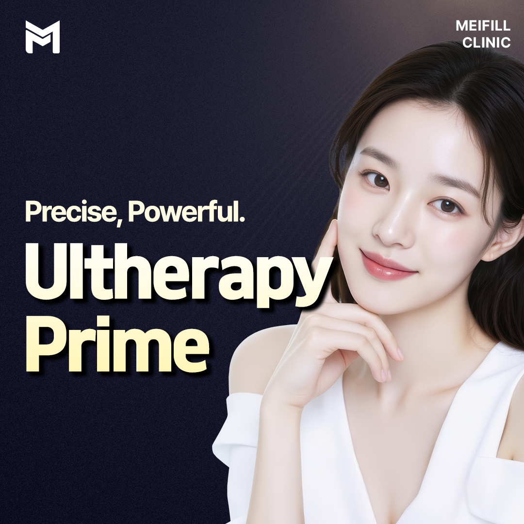 Ultherapy Prime 100 Shots