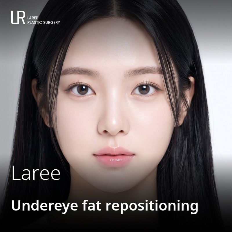 LAREE Undereye fat repositioning