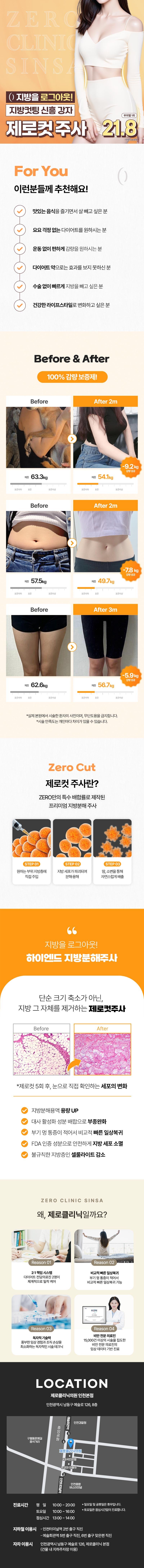 제로의원 인천점에서 제공하는 제로 바디 지방분해주사는 단기간 최대 감량을 원하는 분들을 위한 효과적인 시술입니다.