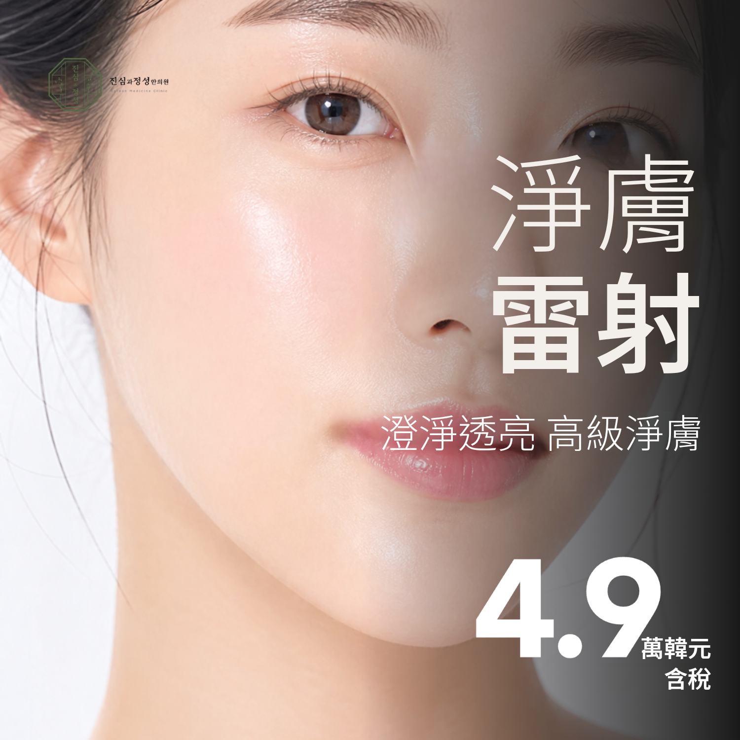 皮秒雷射淨膚｜肝斑、黑斑、瑕疵