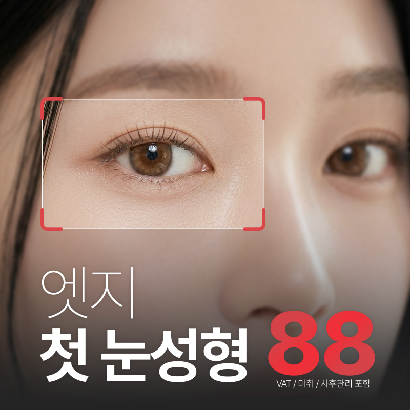 엣지성형외과의원 대구 엣지 눈성형 이벤트 이미지