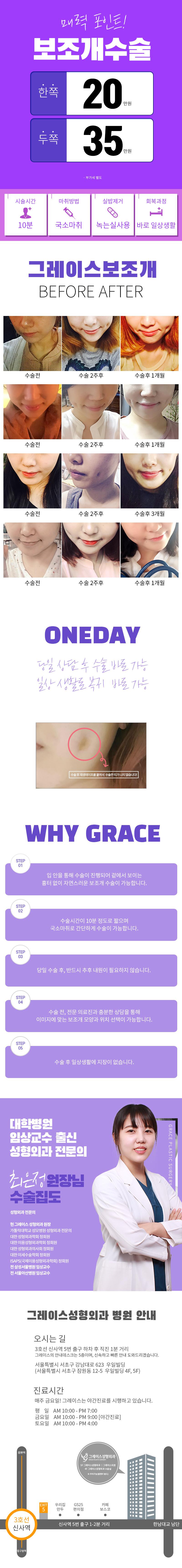 속초 지역 병원의 0404 쁘띠이벤트로 20만원 특가 프로모션을 제공하는 미용 시술 광고