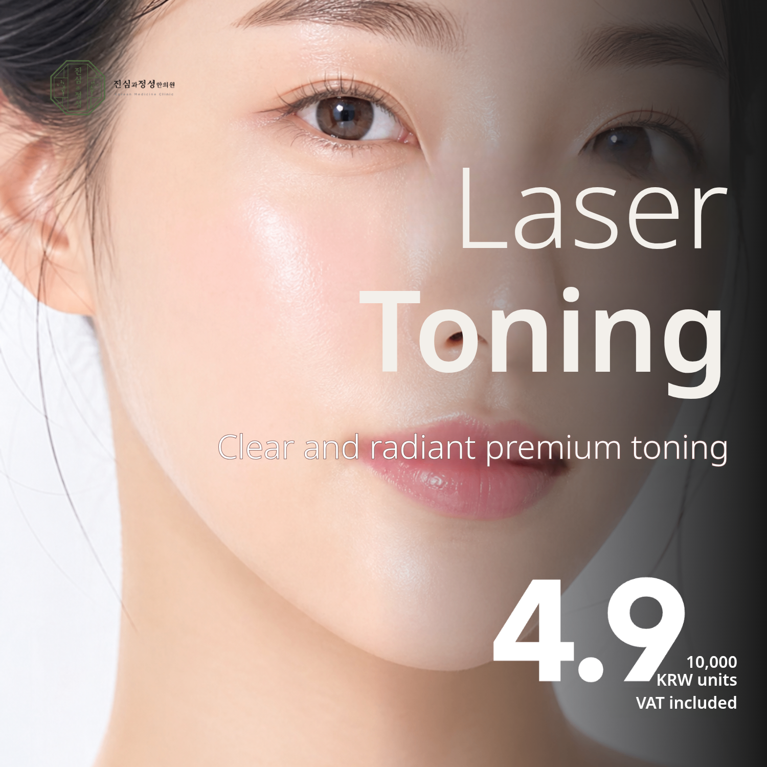 Pico Laser Toning | Melasma, Dark Spots & Blemishes