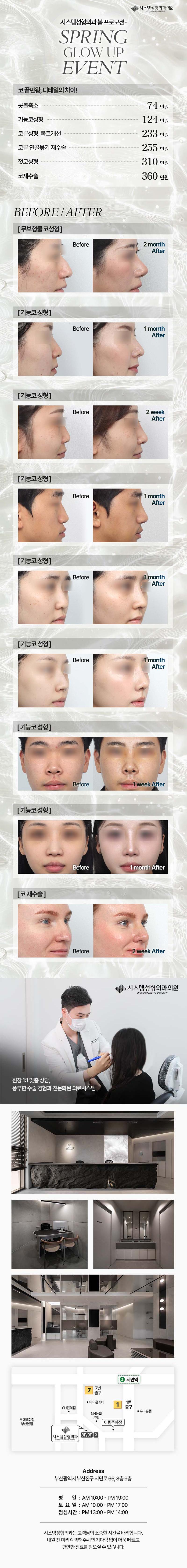 부산 서면에 위치한 시스템성형외과의원에서 제공하는 시스템 코성형은 심미성과 기능성을 개선하는 코성형 시술입니다.