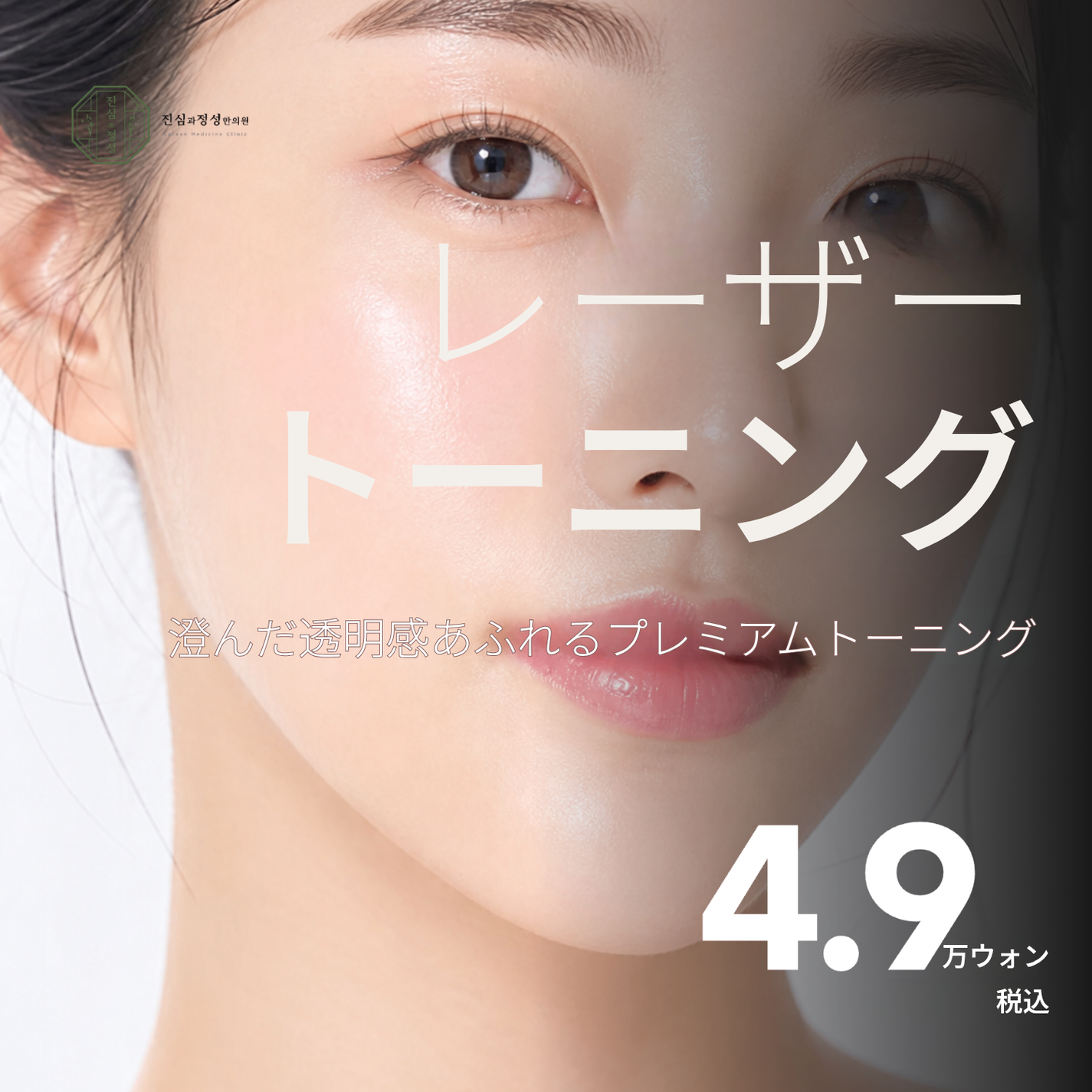 ピコレーザートーニング｜シミ・そばかす・くすみ