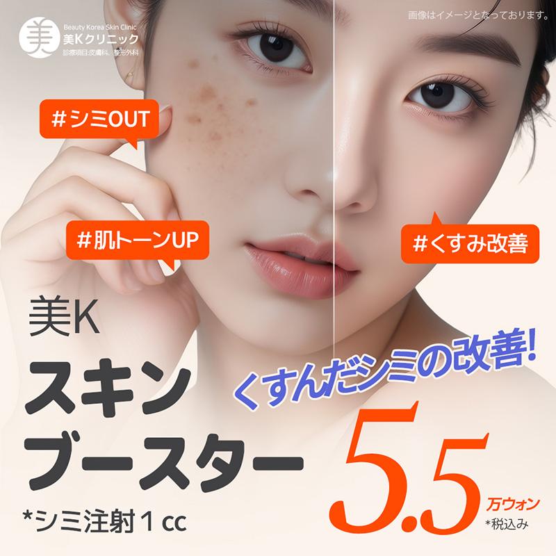 美K シミ & くすみ改善 スキンブースター_シミ注射, 水光注射, リジュランヒーラー, ジュベルック