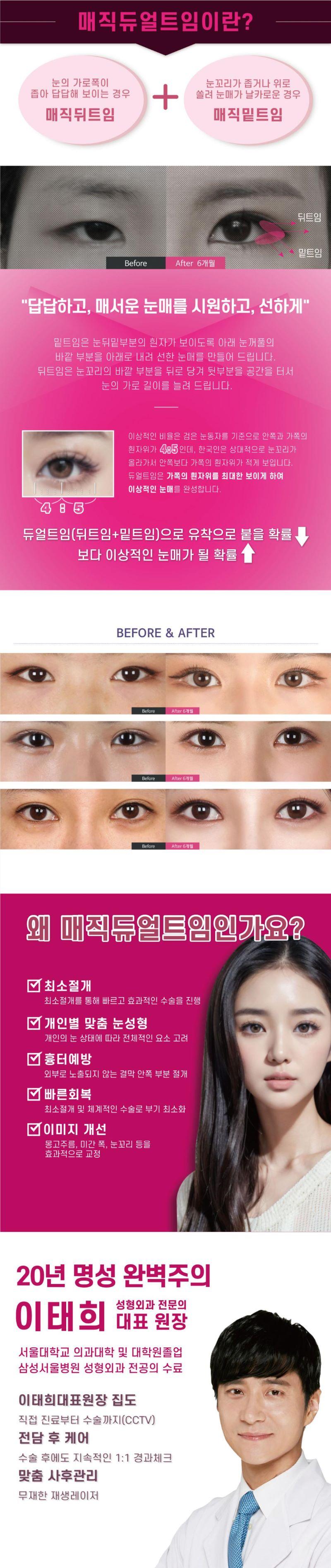 페이스라인 성형외과의 매직듀얼트임 99는 쌍꺼풀과 눈매교정을 동시에 진행하는 맞춤형 눈성형 시술입니다